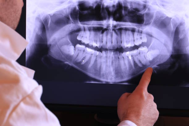 Best Emergency Tooth Extraction in Bellwood, VA