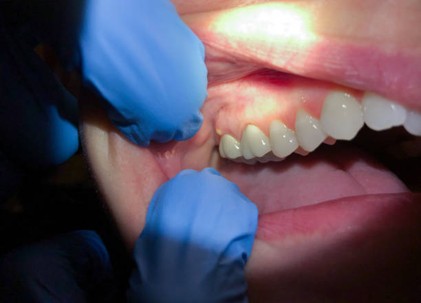 Best Emergency Dental Care for Trauma or Injury in Bellwood, VA