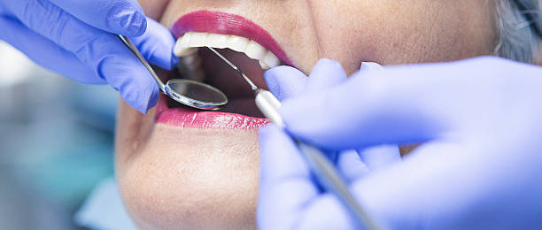 Best Emergency Root Canal Treatment in Bellwood, VA