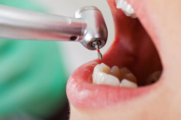 Best Emergency Treatment for Toothache in Bellwood, VA